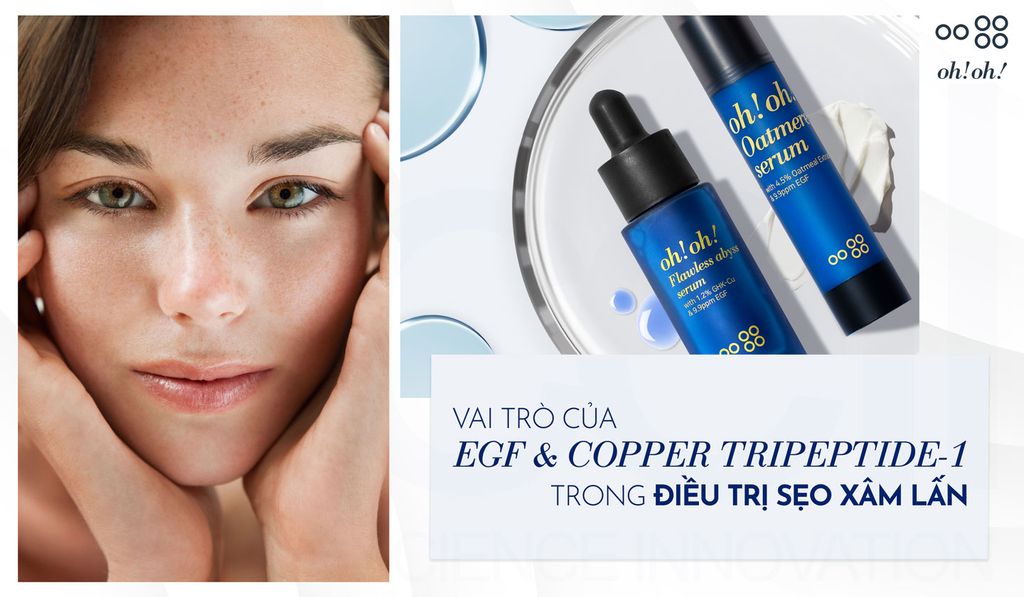 VAI TRÒ CỦA EGF & COPPER TRIPEPTIDE-1 TRONG ĐIỀU TRỊ SẸO XÂM LẤN